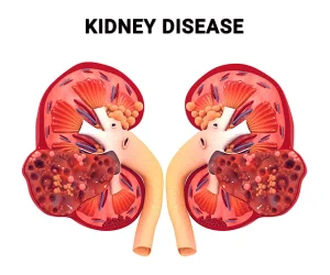 Nephrologist