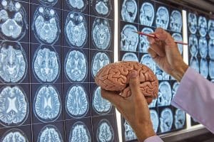 Neurosurgeon