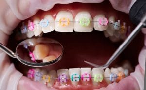 Orthodontist