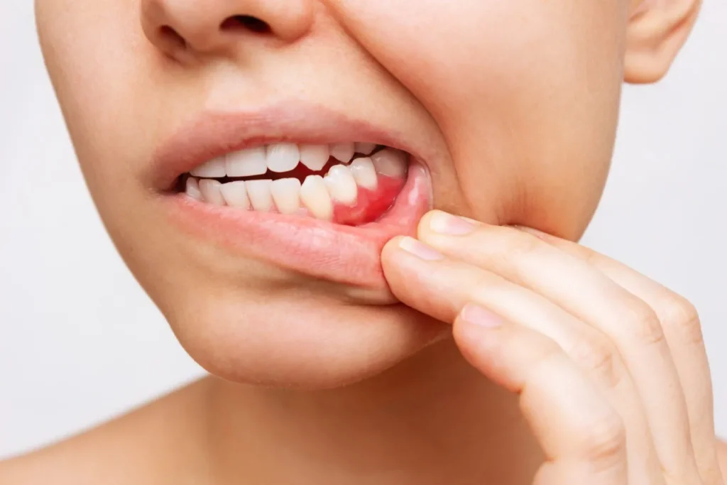 Periodontist